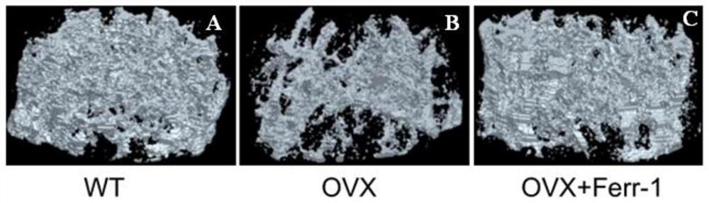 Use of ferrostatin-1 in the treatment of osteoporosis