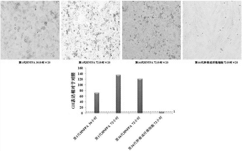 Establishment and applications of human pituitary adenoma cell line