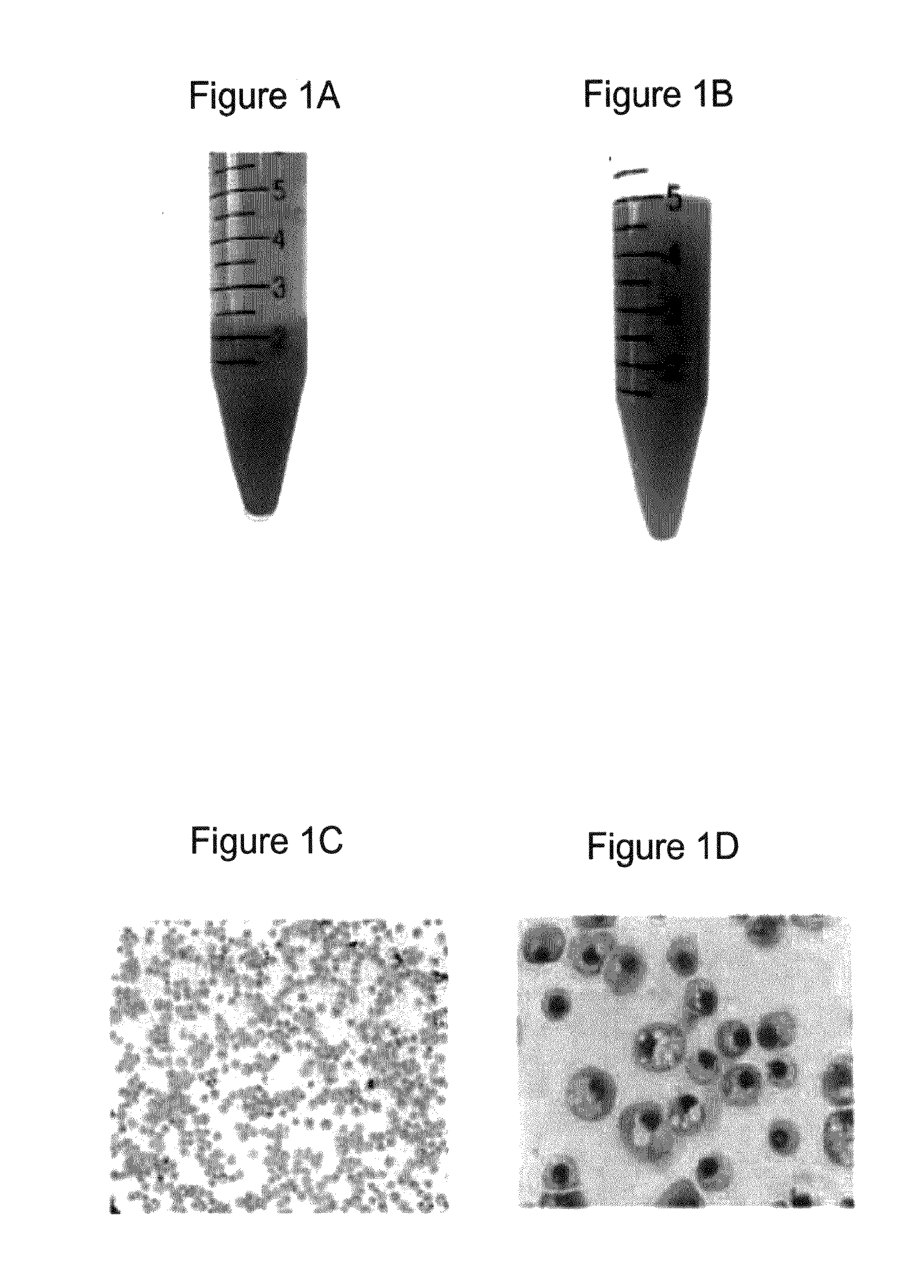 Methods for producing enucleated erythroid cells derived from pluripotent stem cells
