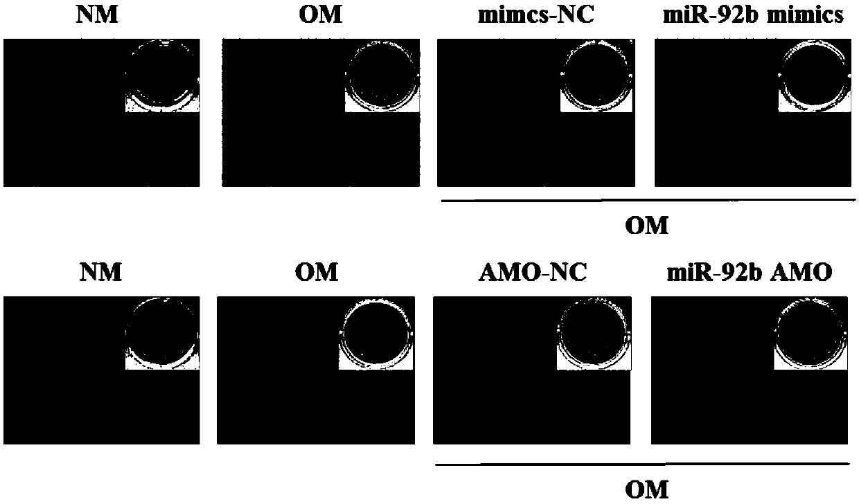 Application of miR-92b and simulant thereof in promoting osteogenic differentiation of bone marrow mesenchymal stem cells and bone formation