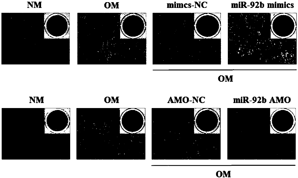 Application of miR-92b and simulant thereof in promoting osteogenic differentiation of bone marrow mesenchymal stem cells and bone formation