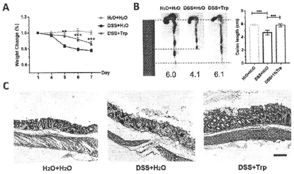 Anti-inflammatory tryptophan enema preparation as well as preparation method and application thereof