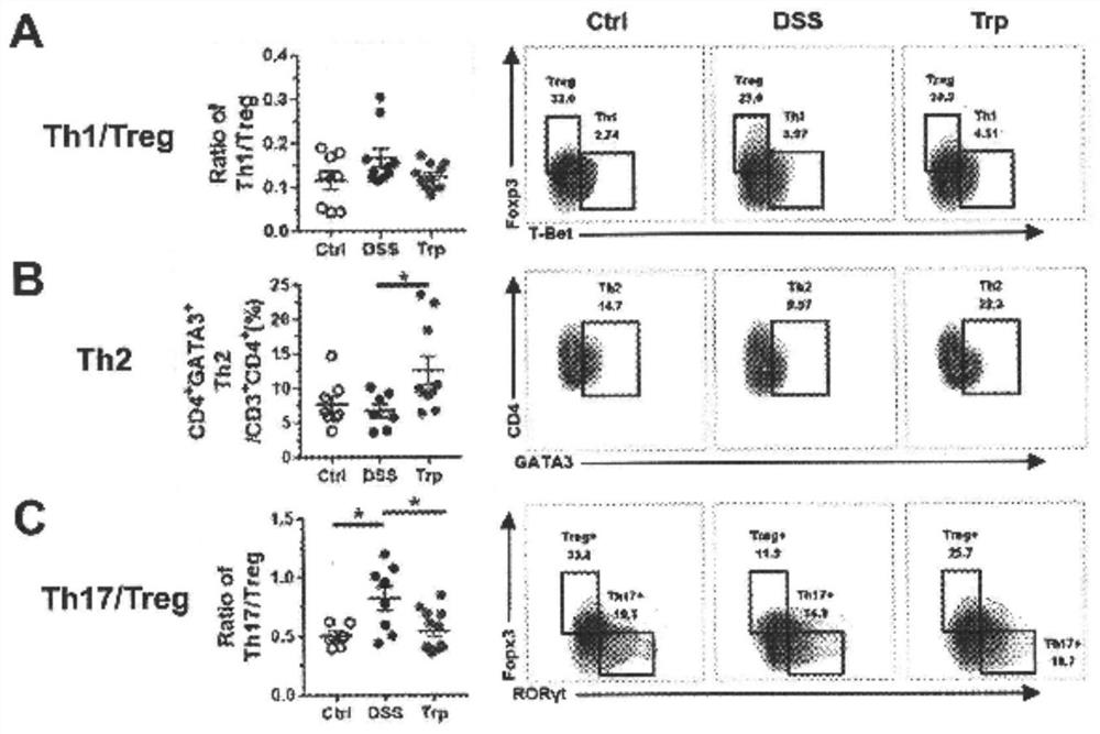 Anti-inflammatory tryptophan enema preparation as well as preparation method and application thereof