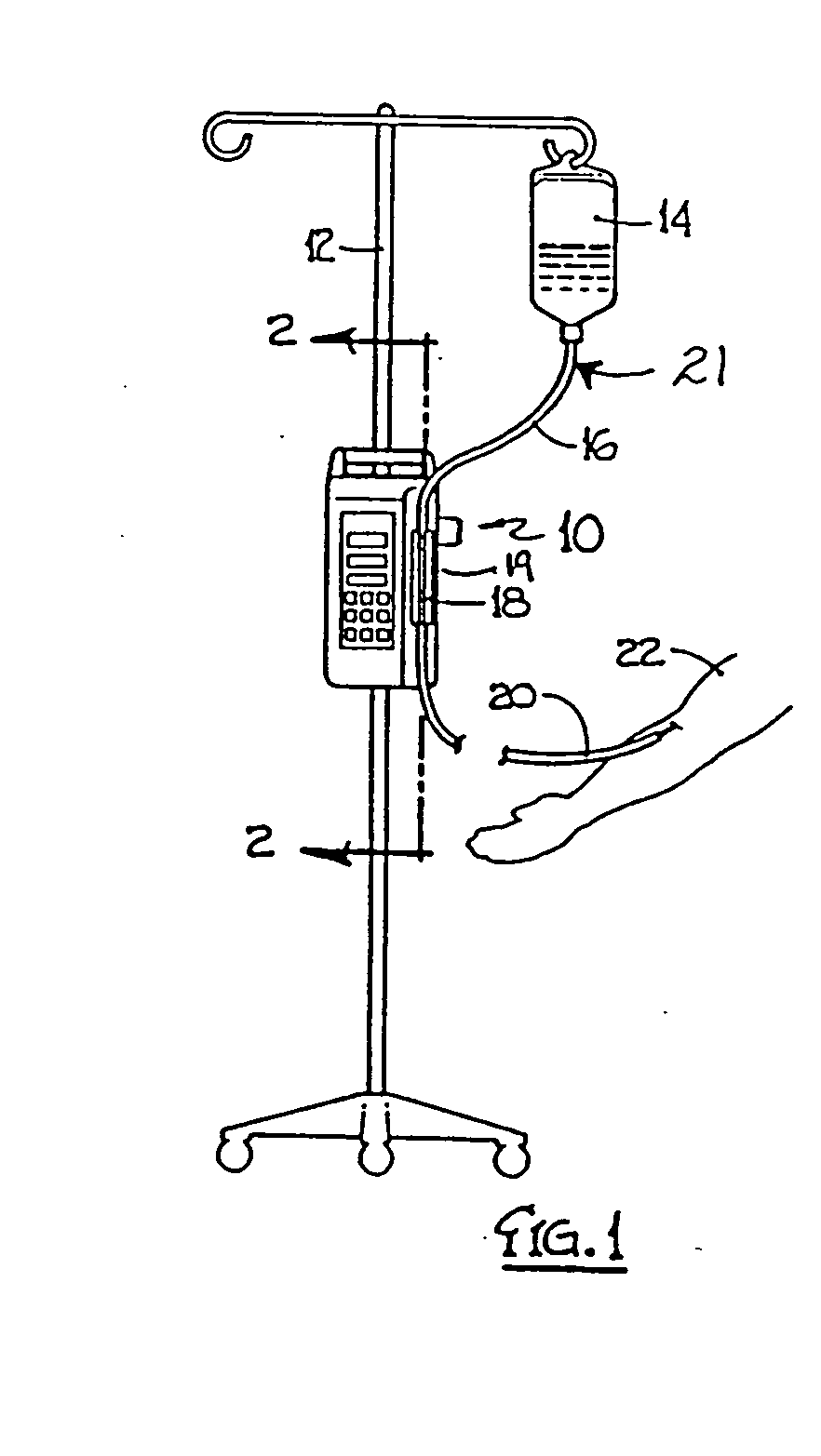 System for detecting the status of a vent associated with a fluid supply upstream of an infusion pump