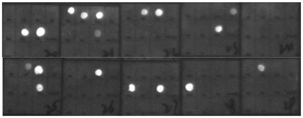 Kit for quantum dot nucleic acid detection of bacterial intestinal pathogen