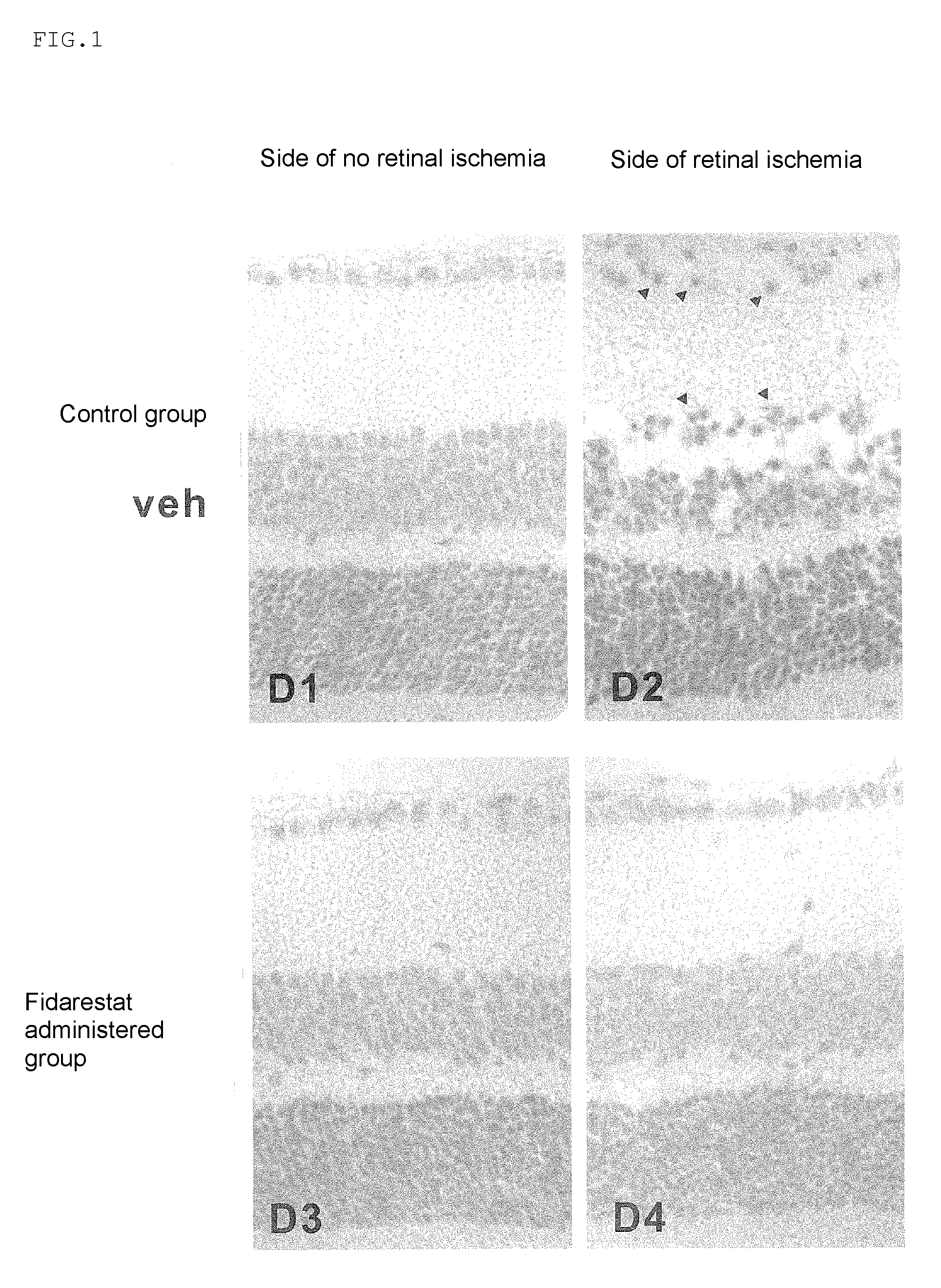 Protective agent for retinal nerve or optic nerve