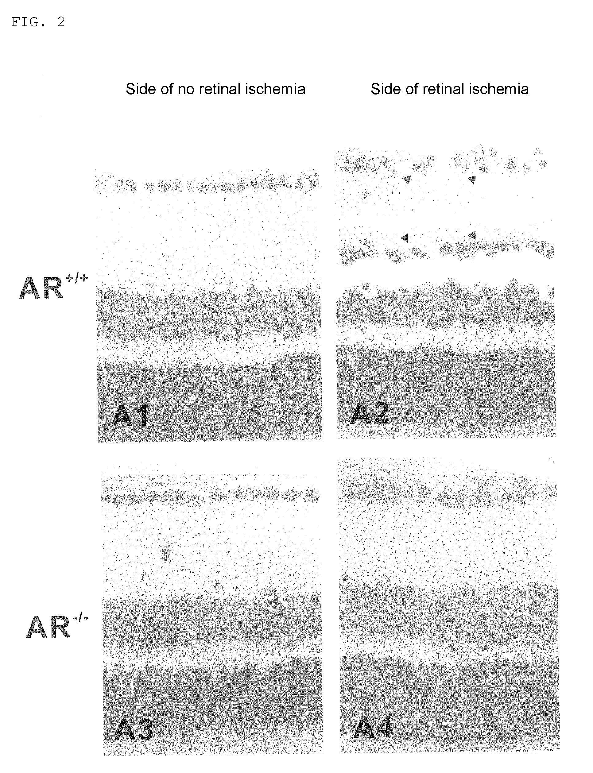 Protective agent for retinal nerve or optic nerve