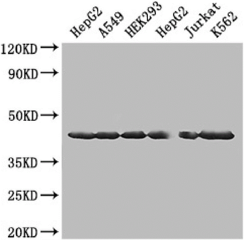 Construction method of expression vector for preparing membrane protein CD14 antibody