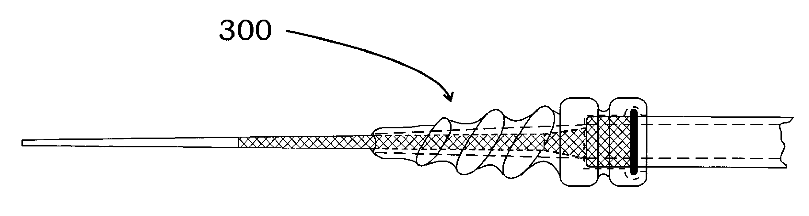 Method and apparatus for creating a pathway in an animal