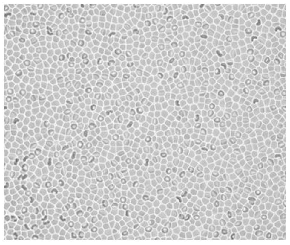 Erythrocyte bionic coating for enriching circulating tumor cells