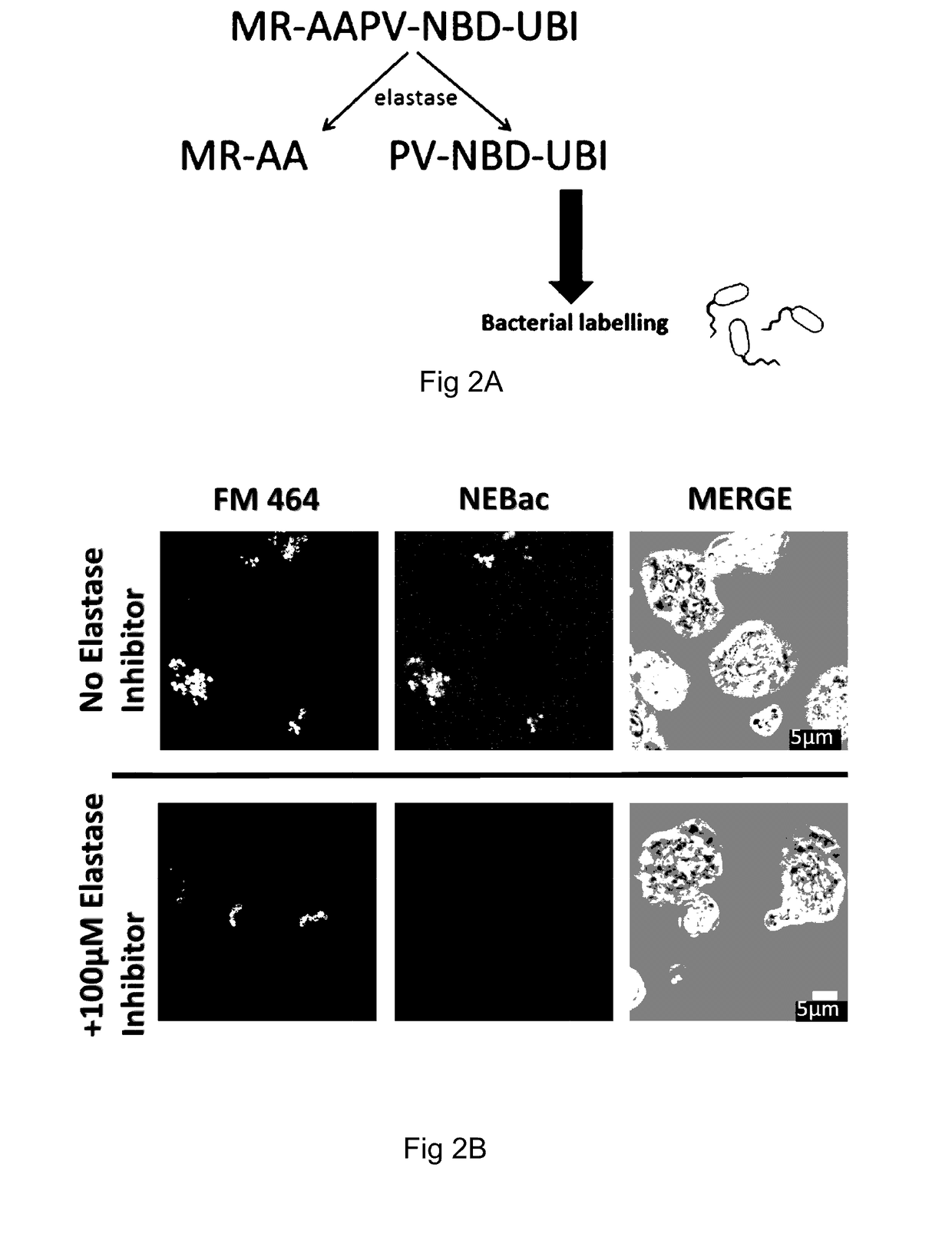 Molecular probes for detecting gram-negative bacteria in vitro and in vivo