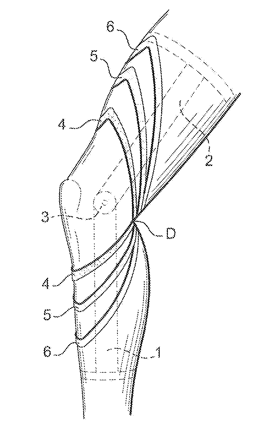 Knee orthosis for torn anterior cruciate ligament