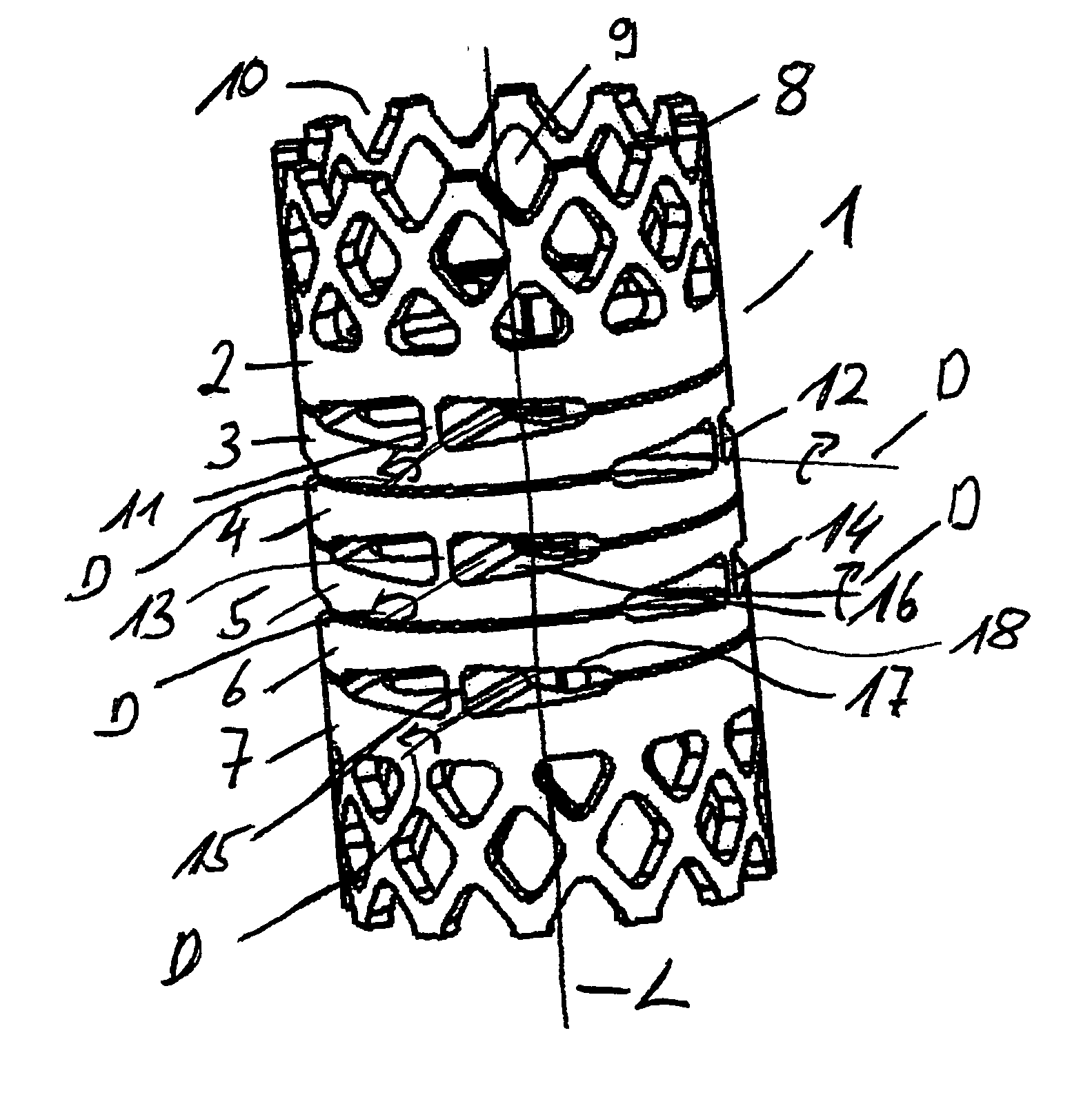 Implant with one piece swivel joint