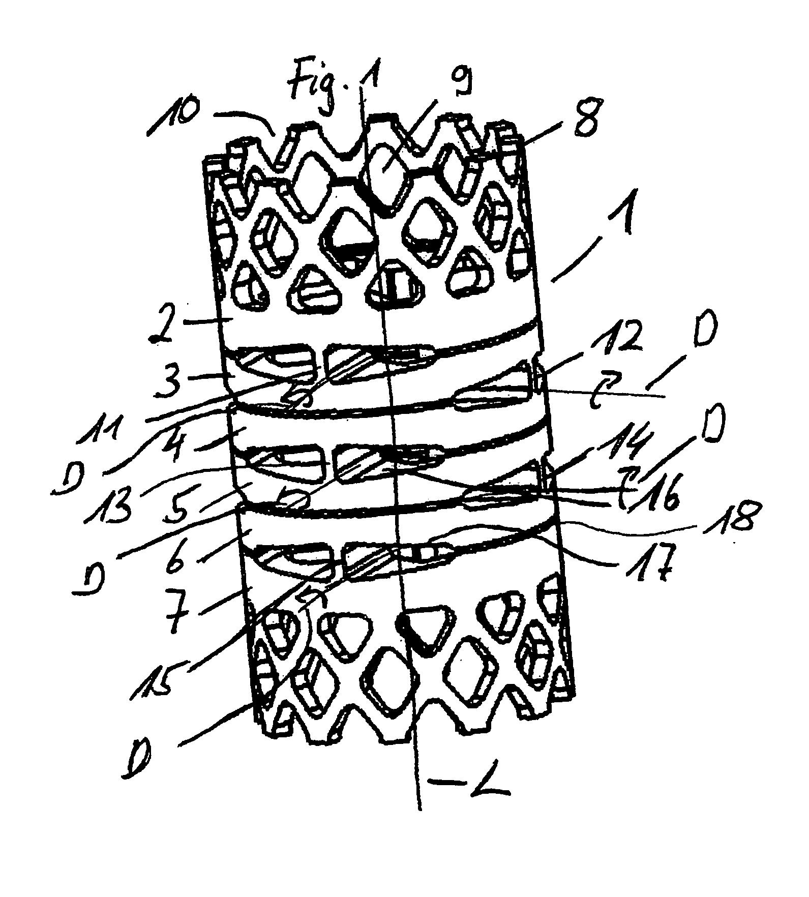 Implant with one piece swivel joint