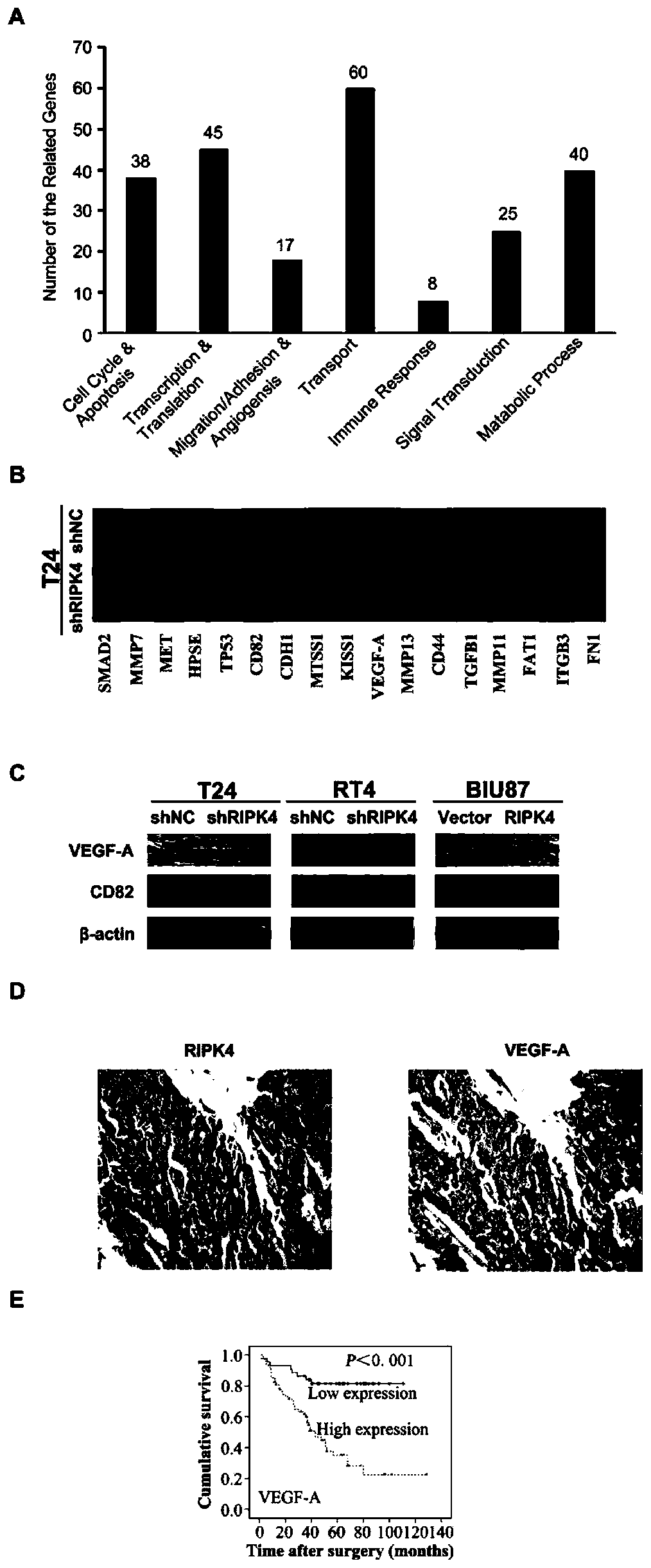 Application of ripk4 as a target site in the preparation of drugs for the treatment of bladder cancer