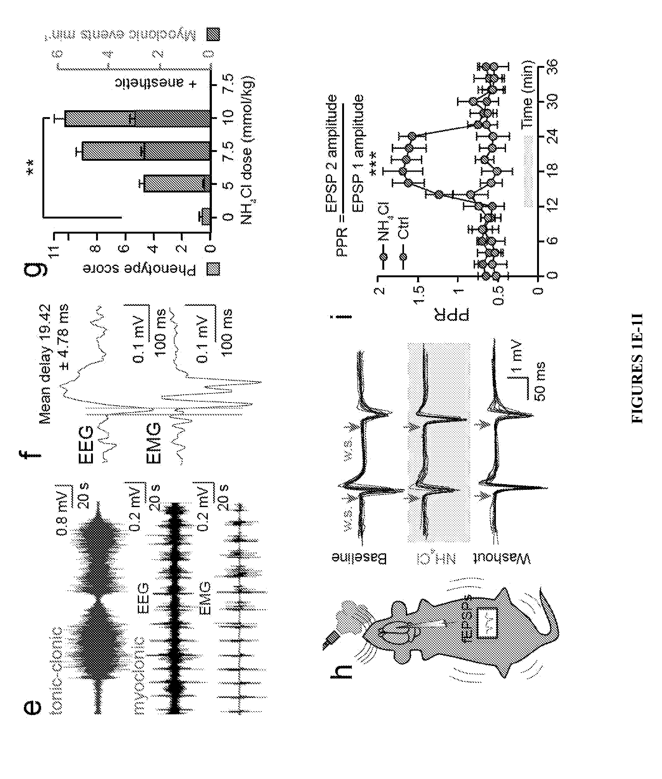 METHOD OF TREATING AND PREVENTING BRAIN IMPAIRMENT USING Na+-K+-2Cl- COTRANSPORTER ISOFORM 1 INHIBITORS