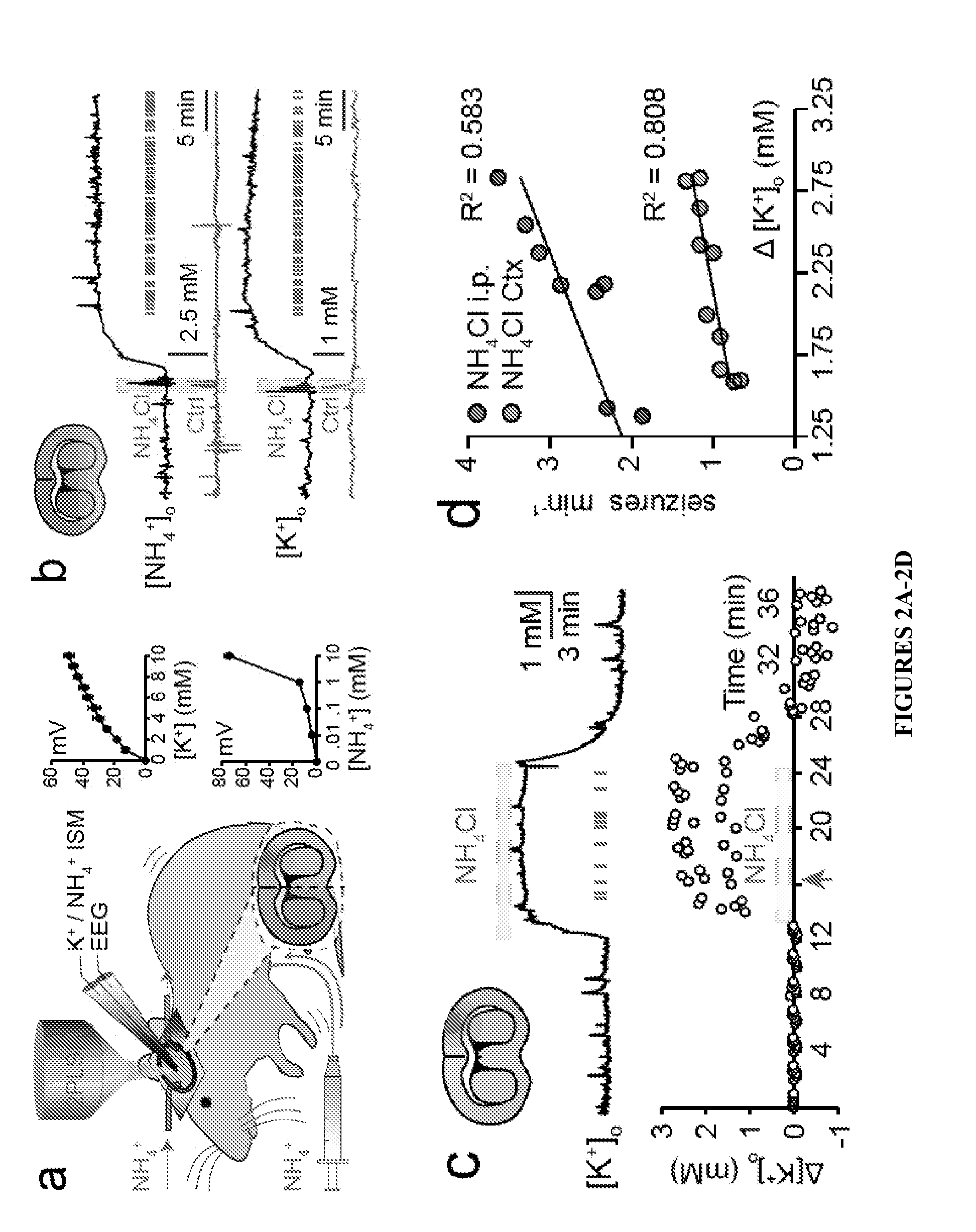 METHOD OF TREATING AND PREVENTING BRAIN IMPAIRMENT USING Na+-K+-2Cl- COTRANSPORTER ISOFORM 1 INHIBITORS