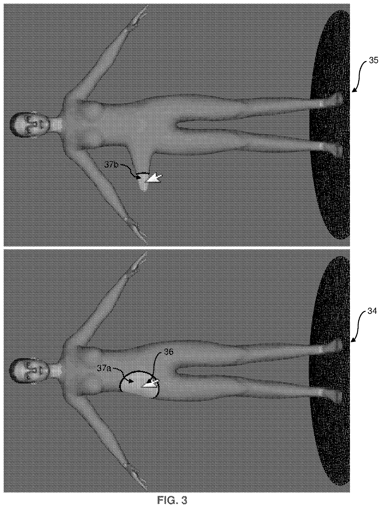 Computerized method for creating and editing surfaces to represent garments on the body of a mannequin in a virtual three-dimensional environment