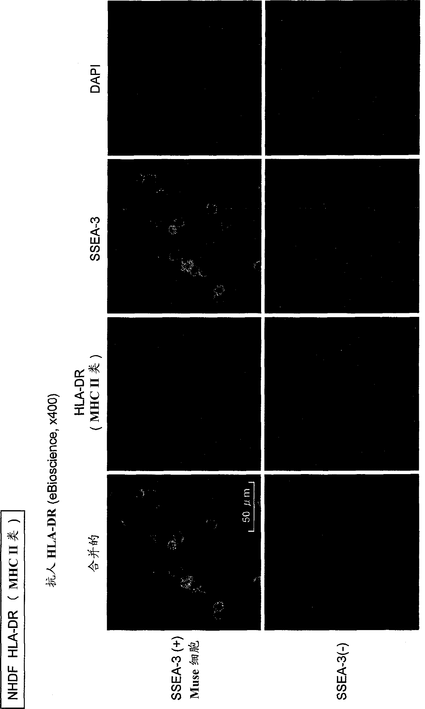 Composition for allotransplantation cell therapy, said composition containing SSEA-3 positive pluripotent stem cell capable of being isolated from body tissue