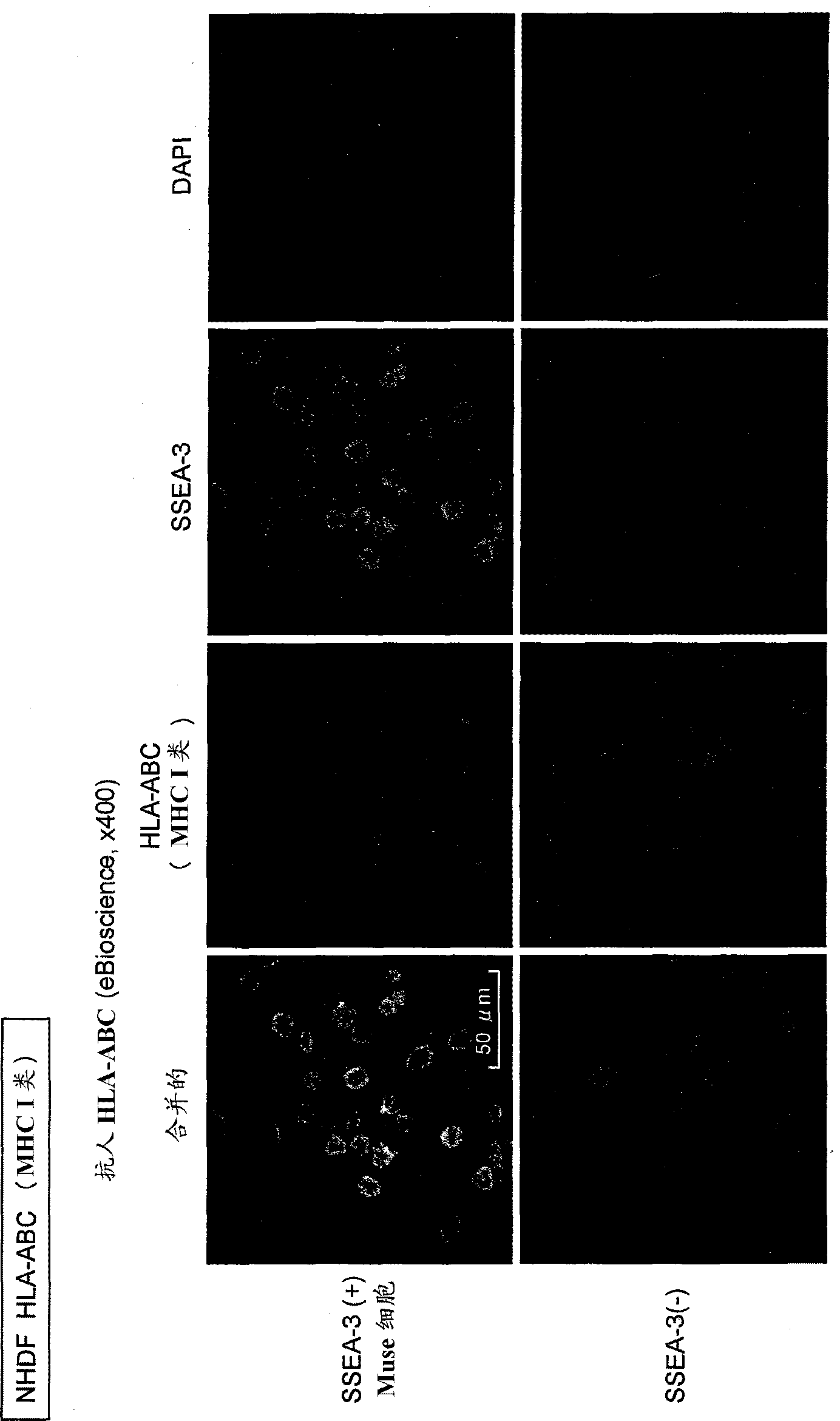 Composition for allotransplantation cell therapy, said composition containing SSEA-3 positive pluripotent stem cell capable of being isolated from body tissue