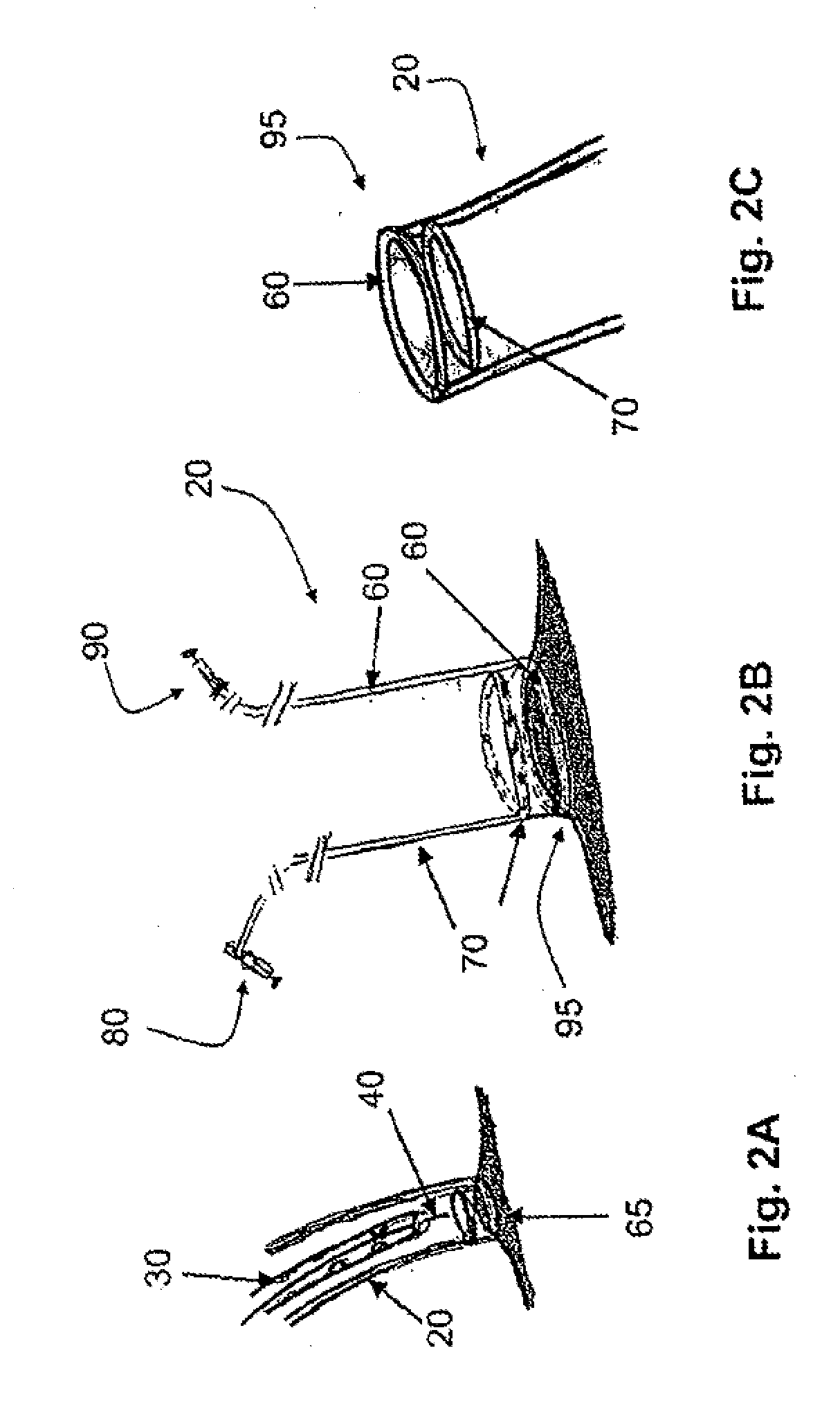 Steering engagement catheter devices, systems, and methods