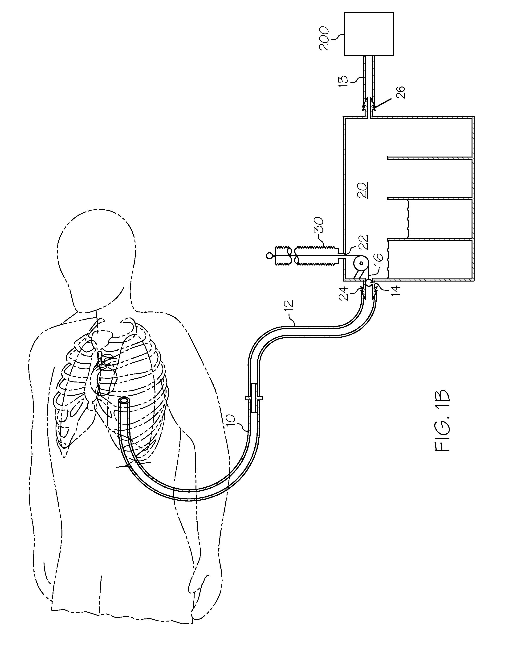Methods and devices to clear obstructions from medical tubes