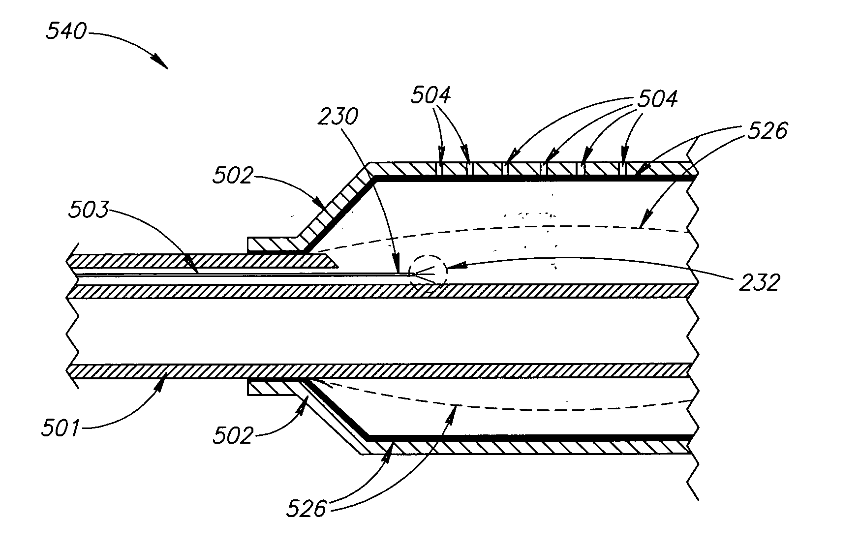 Material delivery system