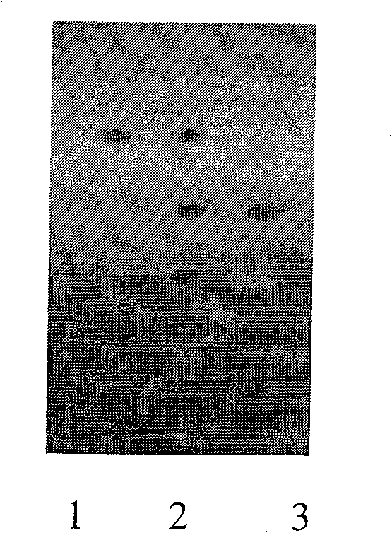 Process for preparing iris aglycone and use thereof in preparation of medicament for treating atherosclerosis