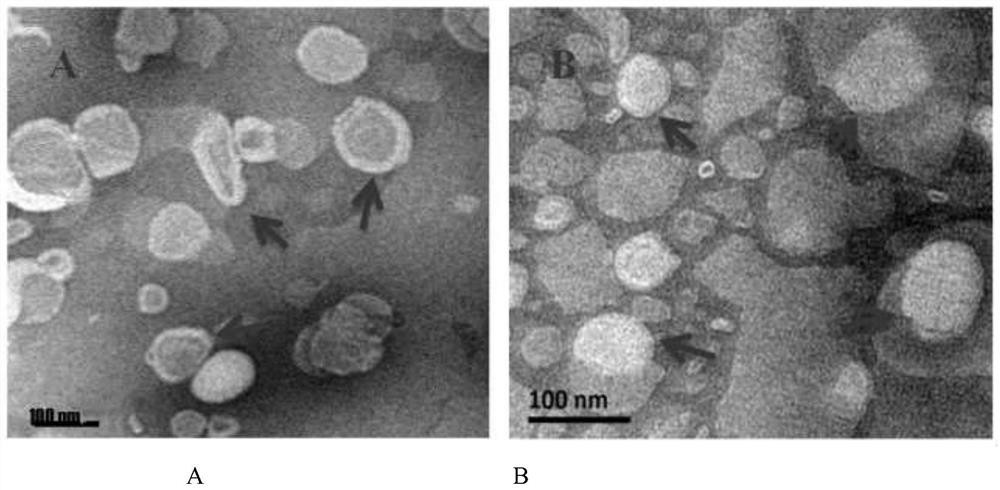 Application of litsea cubeba essential oil liposome in anti-inflammation and acne removal