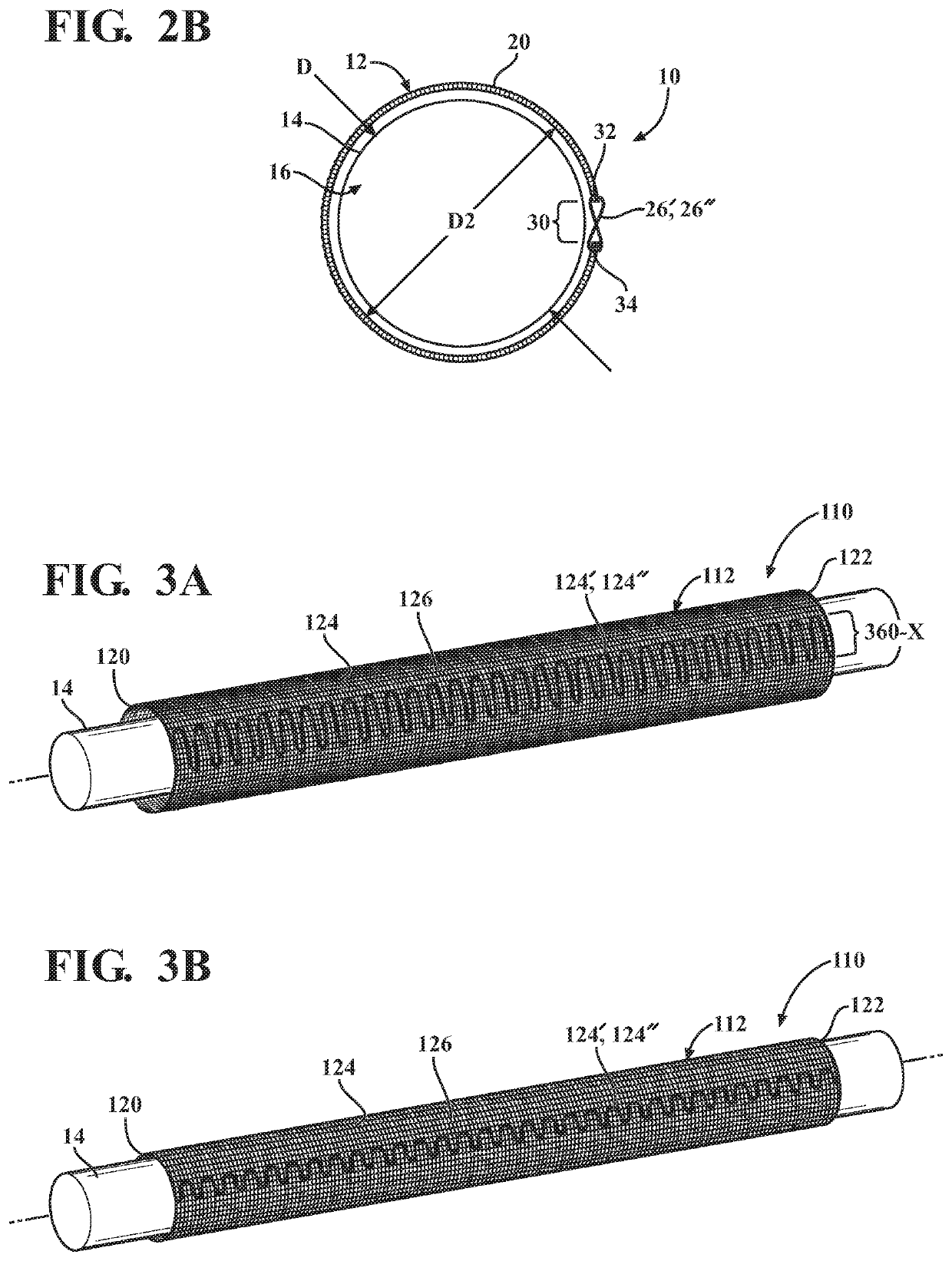 Circumferentially continuous and constrictable textile sleeve and method of construction thereof