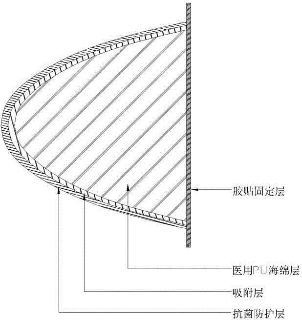 Medical composite shaping restoration material layer for cavity