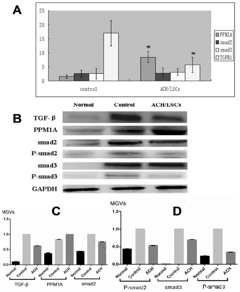 A hydroxyethyl chitosan in situ hydrogel for repairing corneal ocular surface damage