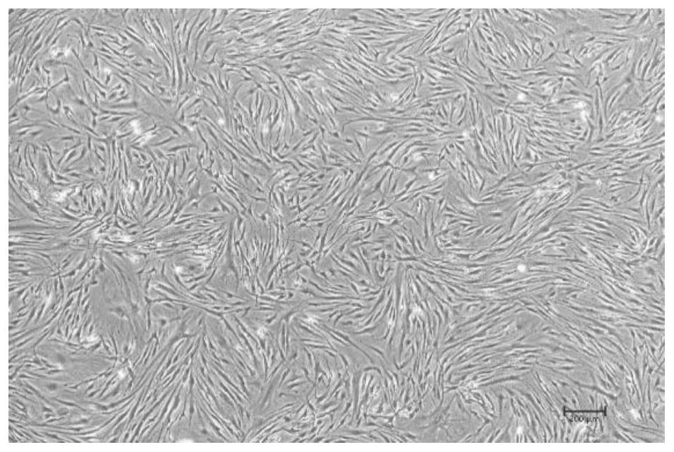 Application of ETV4 gene in reprogramming hypertrophic scar fibroblasts