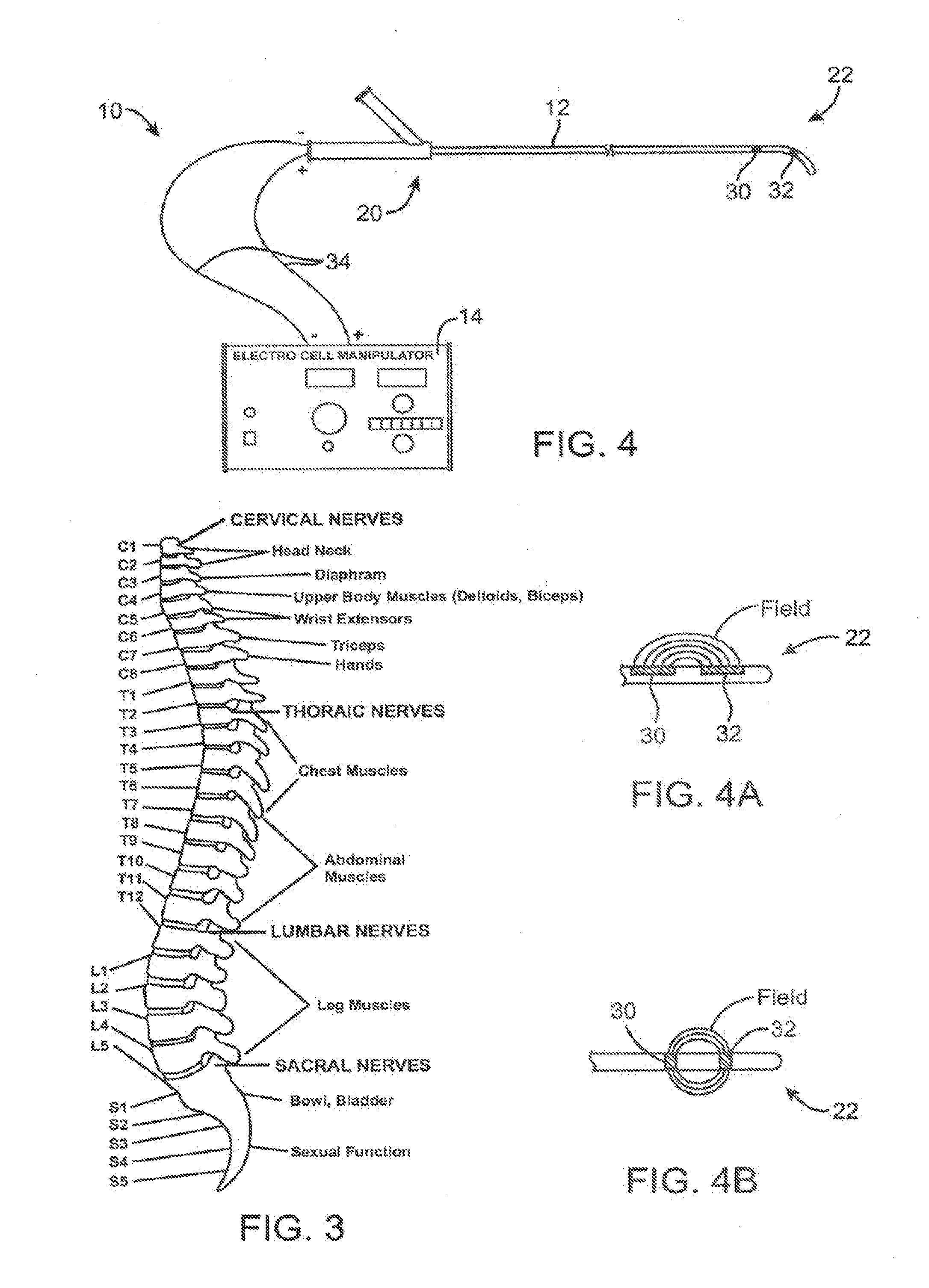 Systems and Methods for Neuromodulation for Treatment of Pain and Other Disorders Associated with Nerve Conduction