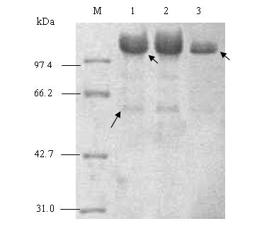 Recombinant humanized collagen and its preparation method
