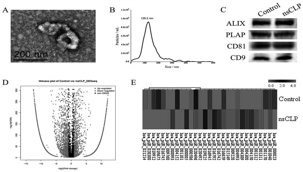 Molecular marker for prenatal noninvasive diagnosis of fetuses with cleft lip and palate, neural tube malformation and congenital heart disease and application of molecular marker