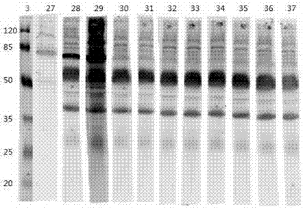 Colloidal gold chromatographic rapid diagnosis test paper strip used for detecting acetylcholine esterase and preparation method thereof