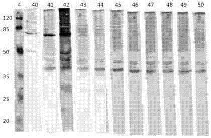 Colloidal gold chromatographic rapid diagnosis test paper strip used for detecting acetylcholine esterase and preparation method thereof
