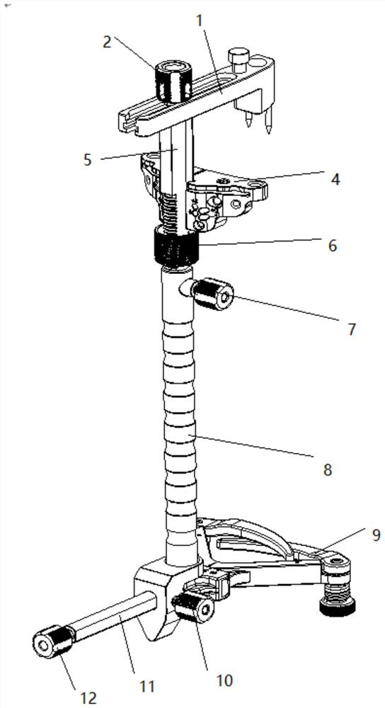 Tibia osteotomy extramedullary and intramedullary multifunctional positioning system