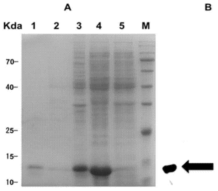 Immunity-protective Acinetobacter baumannii surface antigen SurAl