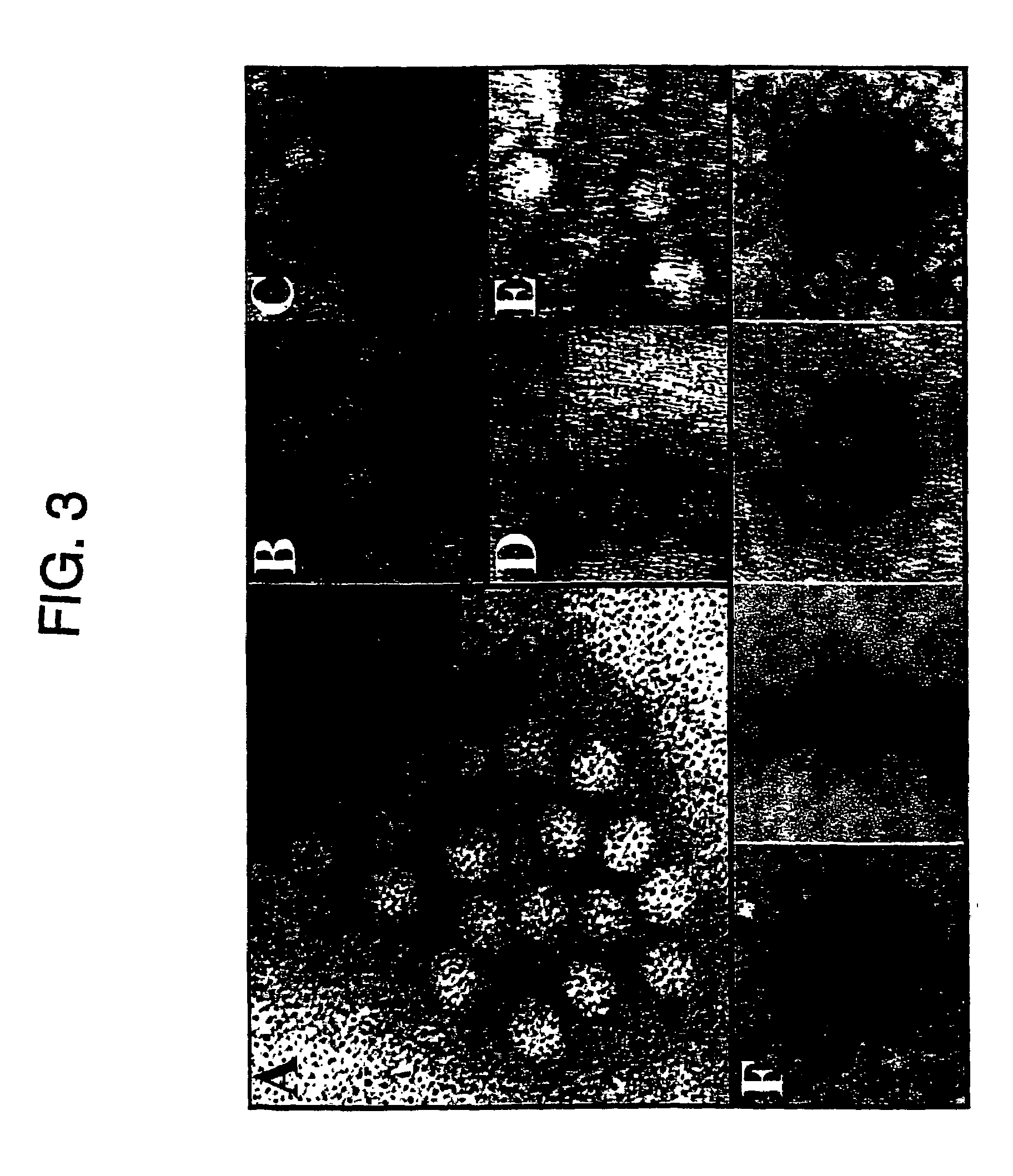 Virus vectors and methods of making and administering the same