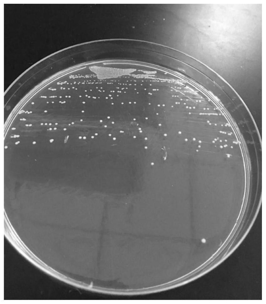Bifidobacterium adolescentis ccfm1061, its fermented food and preparation method of bacterial agent