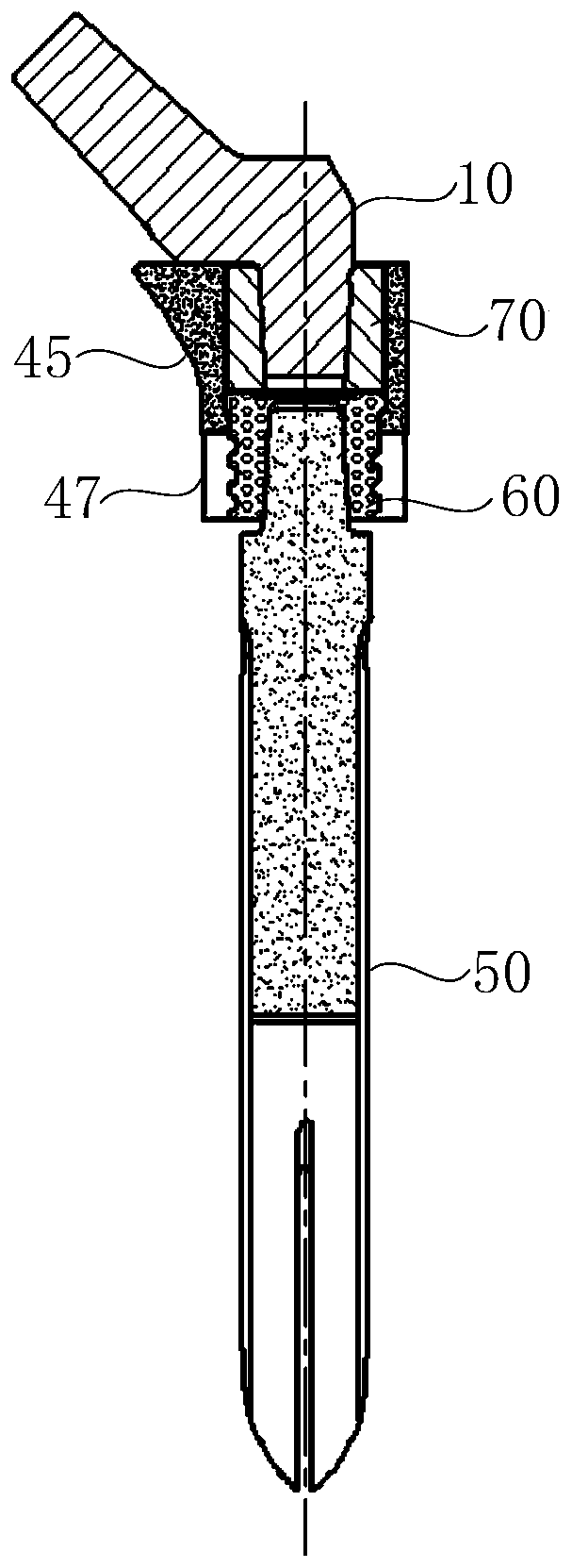 Hip joint prosthesis