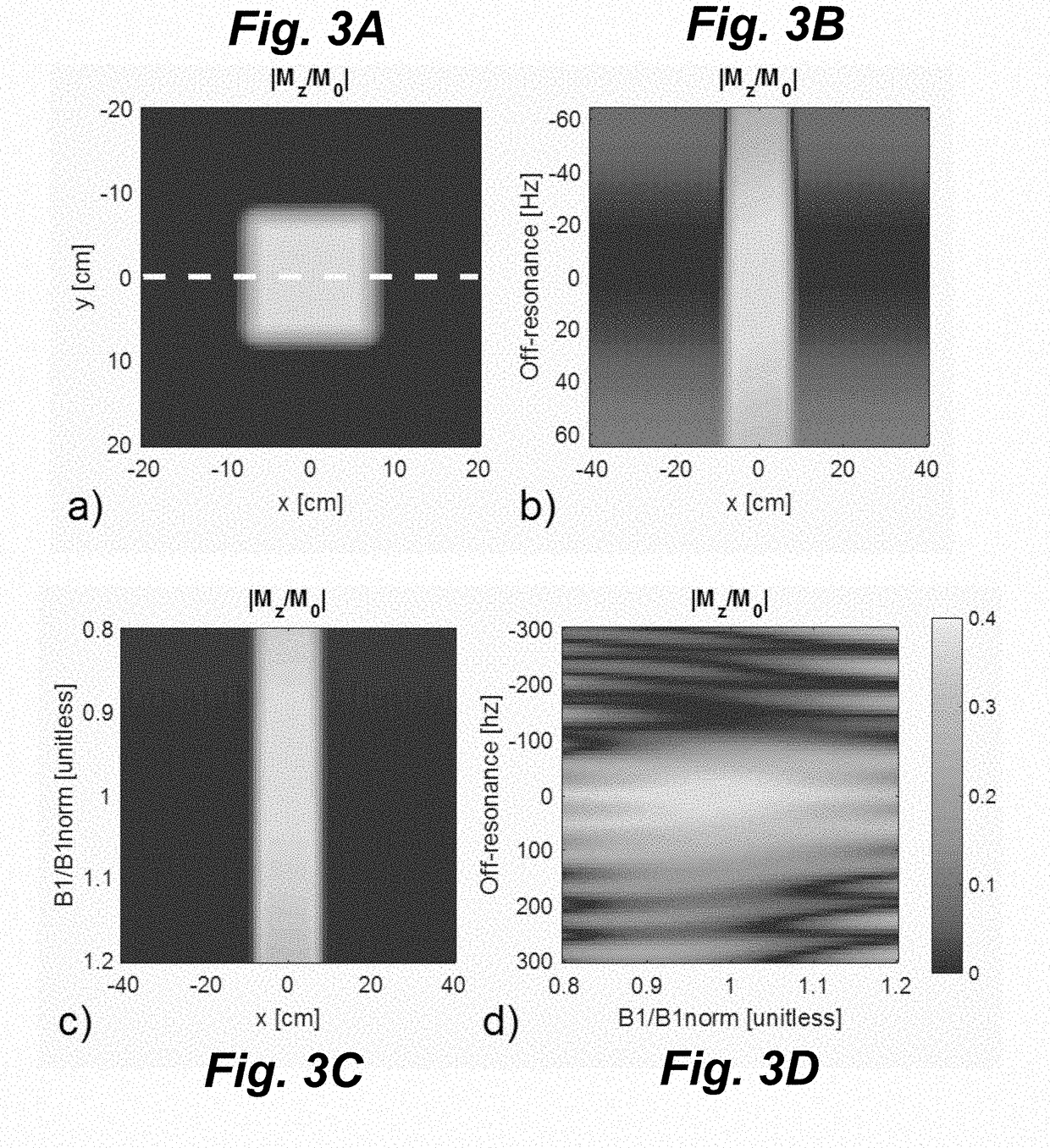 MRI RF Pulse Sequence for Multidimensional Outer Volume Suppression