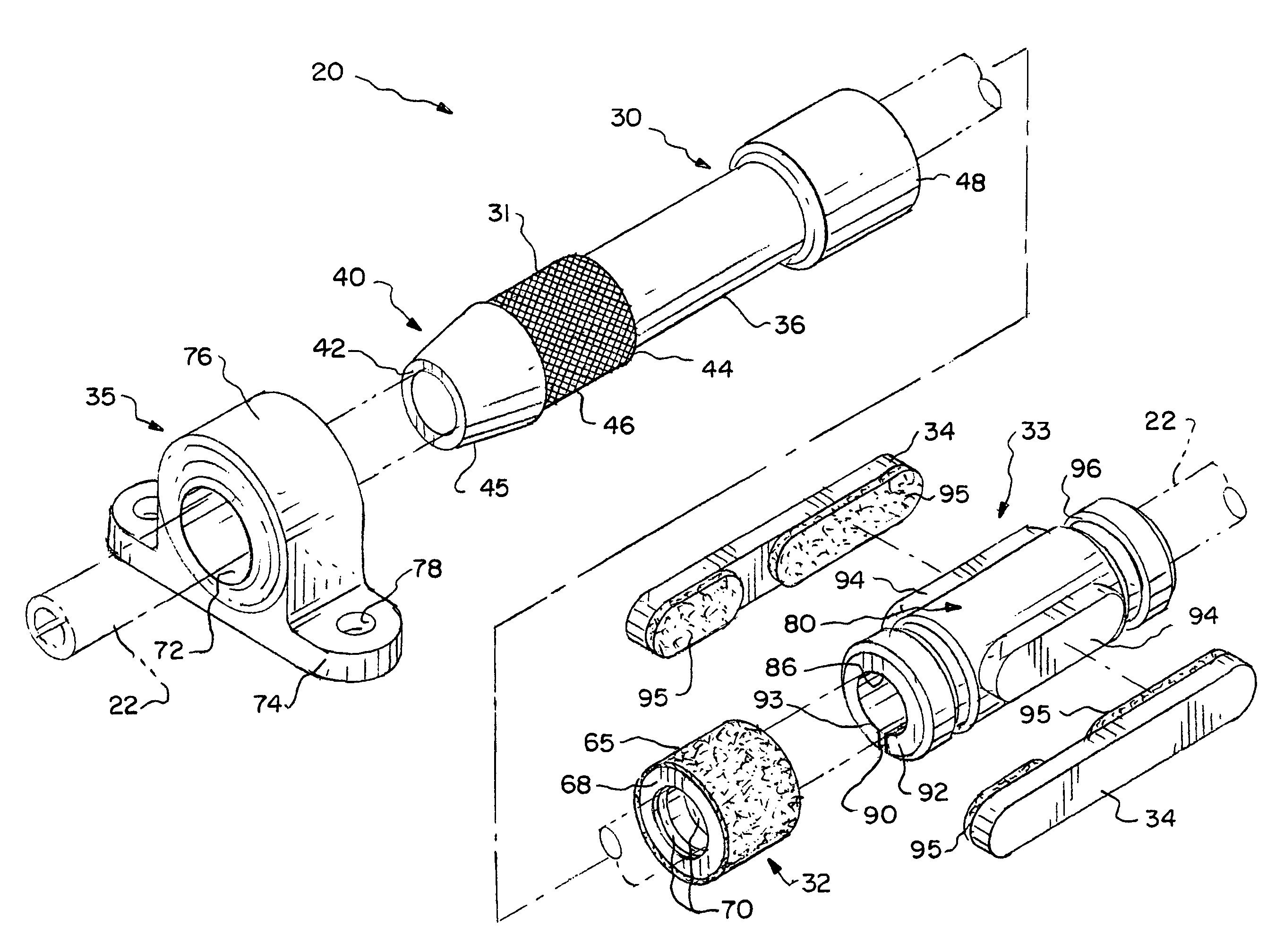 Enhanced apparatus for percutaneous catheter implantation and replacement