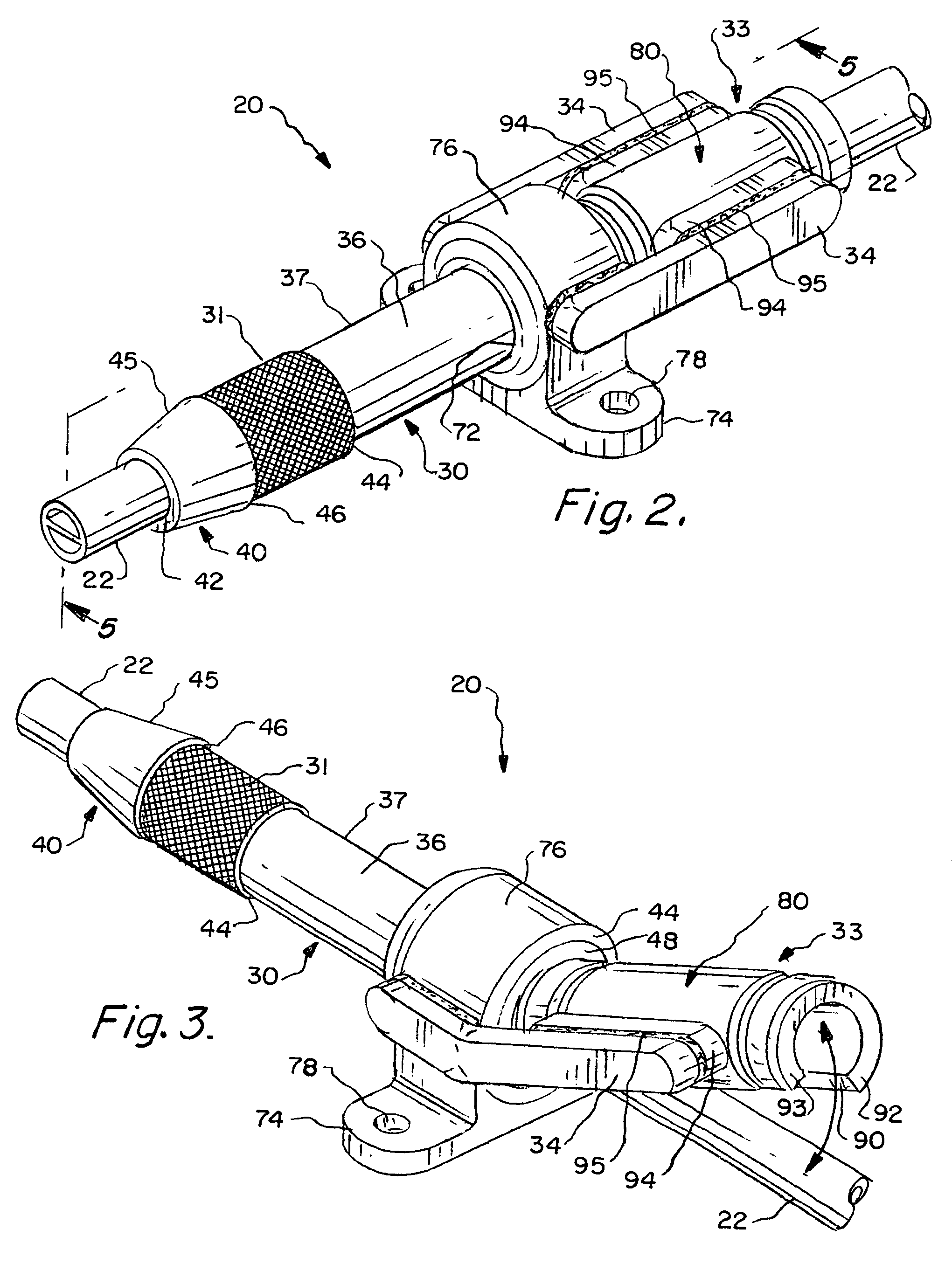 Enhanced apparatus for percutaneous catheter implantation and replacement