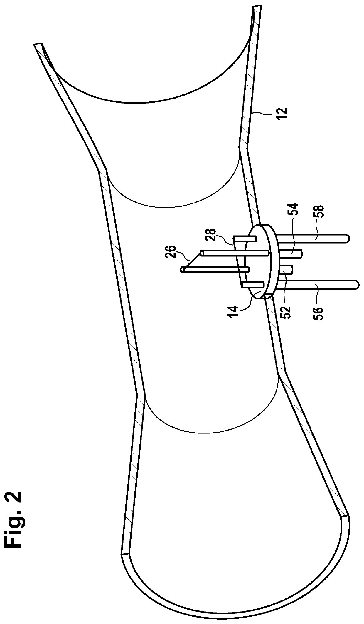 Anesthesia apparatus or ventilator with a hot wire sensor, hot wire sensor and hot wire sensor module for a hot wire sensor