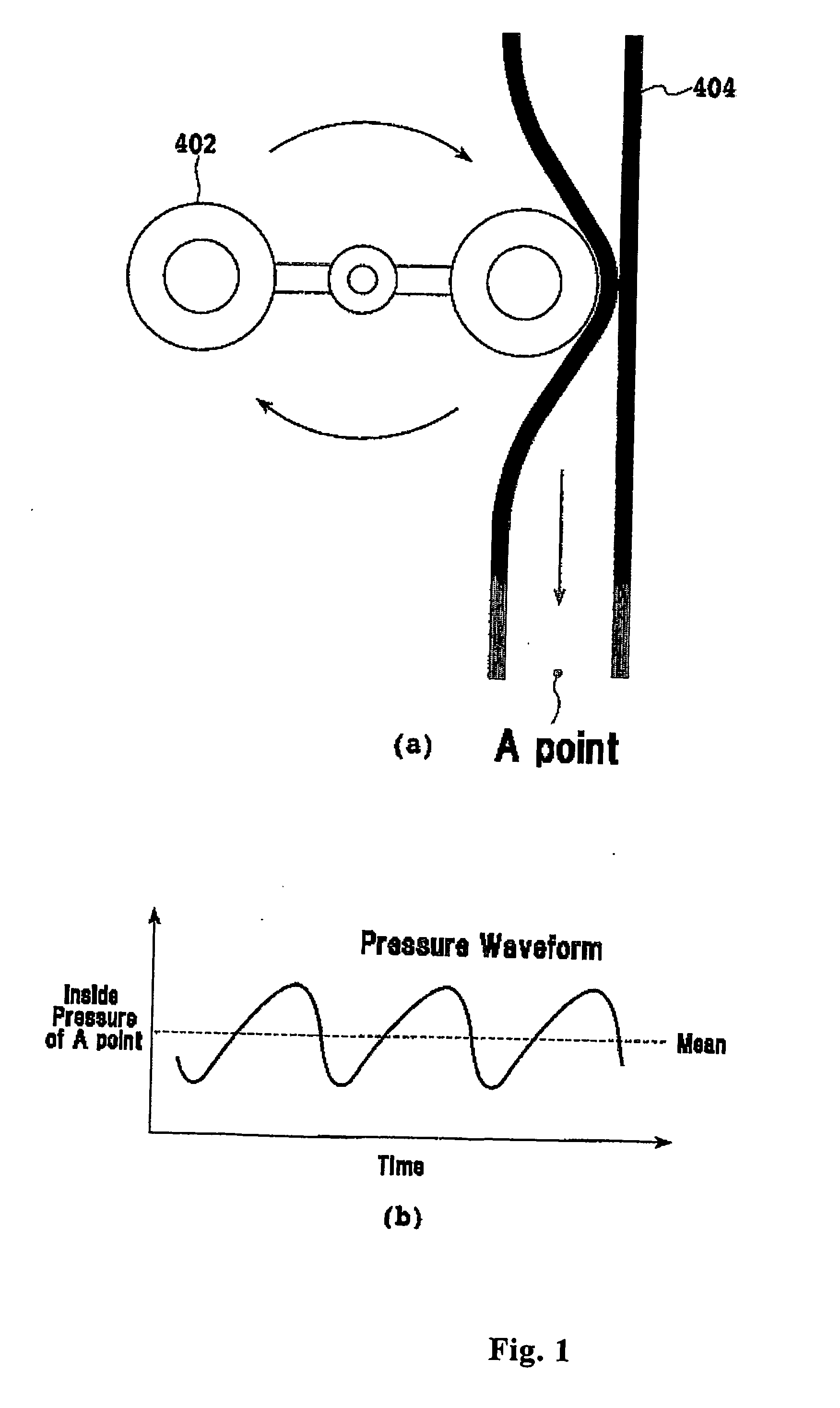 Method for detecting filter clogging by using pressure information, apparatus for monitoring filter clogging and bed-side system