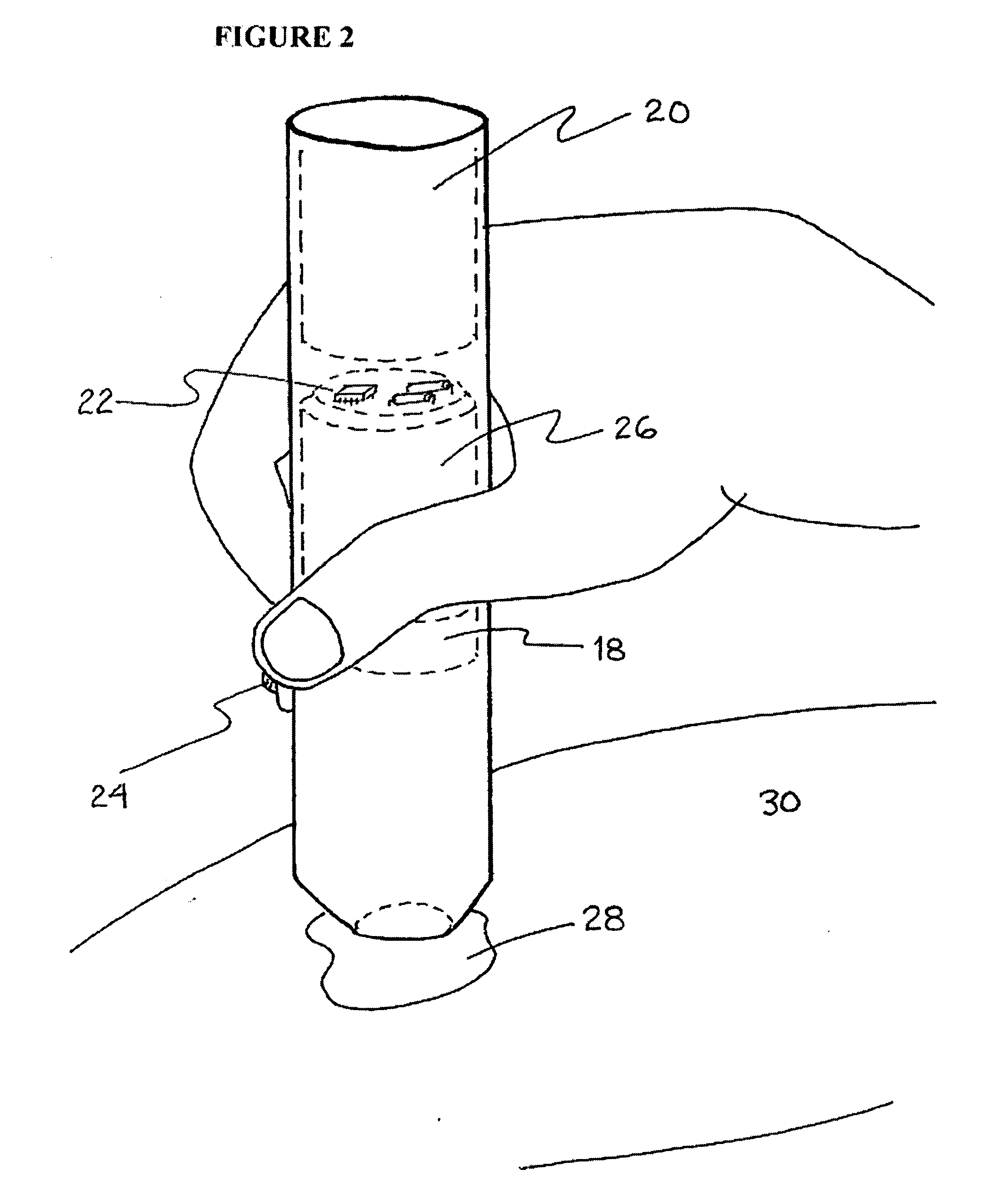 Method and apparatus for the treatment of benign pigmented lesions