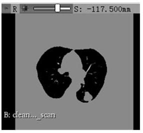 Lung CT image data segmentation method and system